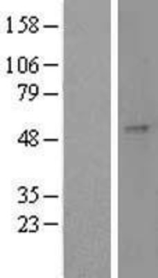 Western Blot: GAL3ST1 Overexpression Lysate (Adult Normal) [NBL1-10943] Left-Empty vector transfected control cell lysate (HEK293 cell lysate); Right -Over-expression Lysate for GAL3ST1.