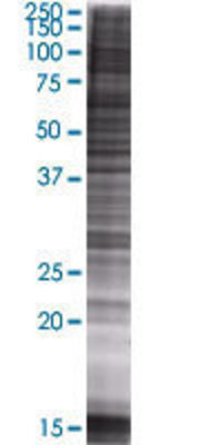 GMPS transfected lysate.