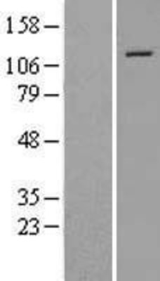 Western Blot: SNF2H Overexpression Lysate (Adult Normal) [NBL1-16228] Left-Empty vector transfected control cell lysate (HEK293 cell lysate); Right -Over-expression Lysate for SNF2H.