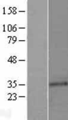Western Blot: Cyclin C Overexpression Lysate (Adult Normal) [NBL1-08869] Left-Empty vector transfected control cell lysate (HEK293 cell lysate); Right -Over-expression Lysate for Cyclin C.