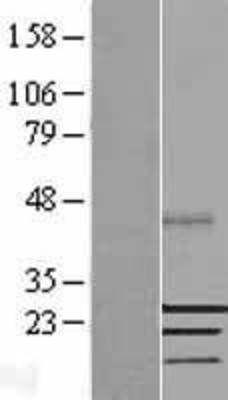 Western Blot: SSX2 Overexpression Lysate (Adult Normal) [NBL1-16484] Left-Empty vector transfected control cell lysate (HEK293 cell lysate); Right -Over-expression Lysate for SSX2.