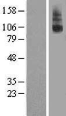 Western Blot: LGR8 Overexpression Lysate (Adult Normal) [NBL1-15638] Left-Empty vector transfected control cell lysate (HEK293 cell lysate); Right -Over-expression Lysate for LGR8.