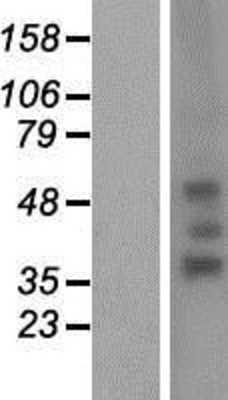 Western Blot: RHD Overexpression Lysate (Adult Normal) [NBP2-07087] Left-Empty vector transfected control cell lysate (HEK293 cell lysate); Right -Over-expression Lysate for RHD.