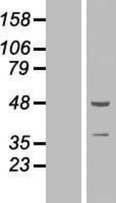 Western Blot: ZNF365 Overexpression Lysate (Adult Normal) [NBP2-07244] Left-Empty vector transfected control cell lysate (HEK293 cell lysate); Right -Over-expression Lysate for ZNF365.