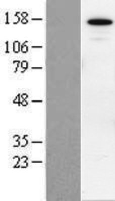 Western Blot: SIN3B Overexpression Lysate (Adult Normal) [NBP2-07193] Left-Empty vector transfected control cell lysate (HEK293 cell lysate); Right -Over-expression Lysate for SIN3B.