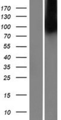 Western Blot: MBTPS2 Overexpression Lysate (Adult Normal) [NBP2-07118] Left-Empty vector transfected control cell lysate (HEK293 cell lysate); Right -Over-expression Lysate for MBTPS2.