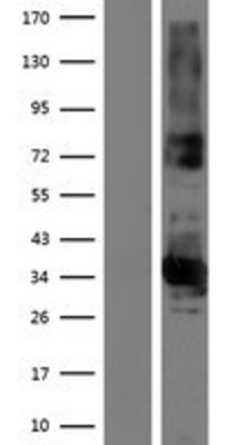 Western Blot: FAM108B1 Overexpression Lysate (Adult Normal) [NBP2-07099] Left-Empty vector transfected control cell lysate (HEK293 cell lysate); Right -Over-expression Lysate for FAM108B1.
