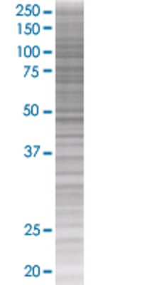 PROS1 transfected lysate.