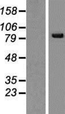 Western Blot: SNRK Overexpression Lysate (Adult Normal) [NBP2-06936] Left-Empty vector transfected control cell lysate (HEK293 cell lysate); Right -Over-expression Lysate for SNRK.