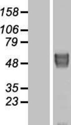 Western Blot: BACE2 Overexpression Lysate (Adult Normal) [NBP2-07491] Left-Empty vector transfected control cell lysate (HEK293 cell lysate); Right -Over-expression Lysate for BACE2.