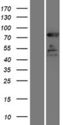 Western Blot: ELMO1 Overexpression Lysate (Adult Normal) [NBP2-07272] Left-Empty vector transfected control cell lysate (HEK293 cell lysate); Right -Over-expression Lysate for ELMO1.