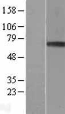 Western Blot: Granulin Overexpression Lysate (Adult Normal) [NBL1-11353] Left-Empty vector transfected control cell lysate (HEK293 cell lysate); Right -Over-expression Lysate for Granulin.