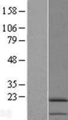 Western Blot: IL11 Overexpression Lysate (Adult Normal) [NBL1-11898] Left-Empty vector transfected control cell lysate (HEK293 cell lysate); Right -Over-expression Lysate for IL11.