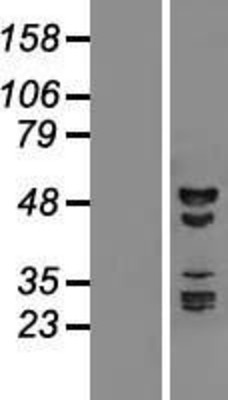 Western Blot: RBM41 Overexpression Lysate (Adult Normal) [NBL1-15211] Left-Empty vector transfected control cell lysate (HEK293 cell lysate); Right -Over-expression Lysate for RBM41.