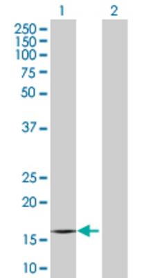 Lane 1: IGF2 transfected lysate (20.1 KDa). Lane 2: Non-transfected lysate.