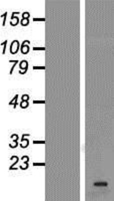 Western Blot: VAMP1 Overexpression Lysate (Adult Normal) [NBP2-07370] Left-Empty vector transfected control cell lysate (HEK293 cell lysate); Right -Over-expression Lysate for VAMP1.