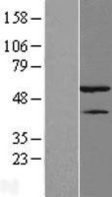 Western Blot: hnRNP H Overexpression Lysate (Adult Normal) [NBL1-11643] Left-Empty vector transfected control cell lysate (HEK293 cell lysate); Right -Over-expression Lysate for hnRNP H.