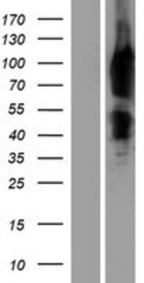 Western Blot: MENA Overexpression Lysate (Adult Normal) [NBP2-10991] Left-Empty vector transfected control cell lysate (HEK293 cell lysate); Right -Over-expression Lysate for MENA.