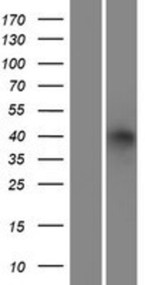 Western Blot: alcohol dehydrogenase 6 Overexpression Lysate (Adult Normal) [NBP2-10948] Left-Empty vector transfected control cell lysate (HEK293 cell lysate); Right -Over-expression Lysate for alcohol dehydrogenase 6.