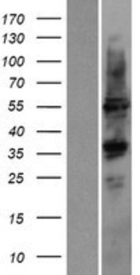 Western Blot: Cytochrome P450 2D6 Overexpression Lysate (Adult Normal) [NBP2-11167] Left-Empty vector transfected control cell lysate (HEK293 cell lysate); Right -Over-expression Lysate for Cytochrome P450 2D6.