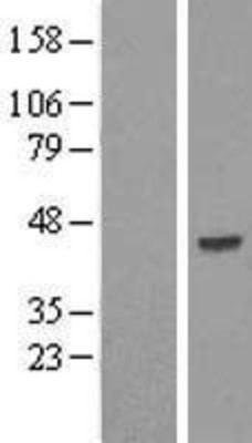 Western Blot: SKIP Overexpression Lysate (Adult Normal) [NBP2-11097] Left-Empty vector transfected control cell lysate (HEK293 cell lysate); Right -Over-expression Lysate for SKIP.