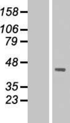 Western Blot: DMRTC2 Overexpression Lysate (Adult Normal) [NBL1-09926] Left-Empty vector transfected control cell lysate (HEK293 cell lysate); Right -Over-expression Lysate for DMRTC2.