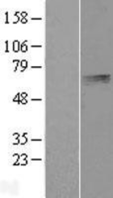Western Blot: PLTP Overexpression Lysate (Adult Normal) [NBL1-14528] Left-Empty vector transfected control cell lysate (HEK293 cell lysate); Right -Over-expression Lysate for PLTP.