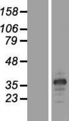 Western Blot: MARCH8 Overexpression Lysate (Adult Normal) [NBL1-07001] Left-Empty vector transfected control cell lysate (HEK293 cell lysate); Right -Over-expression Lysate for MARCH8.