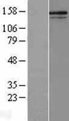 Western Blot: Collagen V alpha 2 Overexpression Lysate (Adult Normal) [NBL1-09355] Left-Empty vector transfected control cell lysate (HEK293 cell lysate); Right -Over-expression Lysate for Collagen V alpha 2.