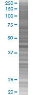 HNRPD transfected lysate.