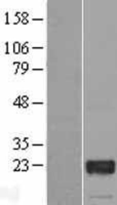 Western Blot: GTSF1 Overexpression Lysate (Adult Normal) [NBL1-11405] Left-Empty vector transfected control cell lysate (HEK293 cell lysate); Right -Over-expression Lysate for GTSF1.