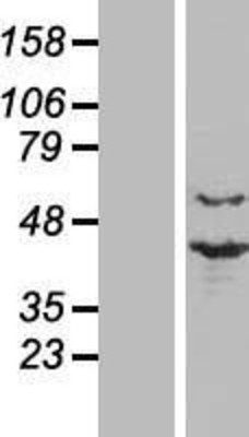 Western Blot: PRP18 Overexpression Lysate (Adult Normal) [NBL1-14816] Left-Empty vector transfected control cell lysate (HEK293 cell lysate); Right -Over-expression Lysate for PRP18.