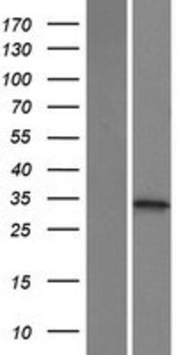 Western Blot: ketohexokinase Overexpression Lysate (Adult Normal) [NBP2-11300] Left-Empty vector transfected control cell lysate (HEK293 cell lysate); Right -Over-expression Lysate for ketohexokinase.