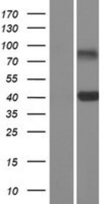 Western Blot: CD301 Overexpression Lysate (Adult Normal) [NBP2-11302] Left-Empty vector transfected control cell lysate (HEK293 cell lysate); Right -Over-expression Lysate for CD301.