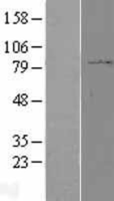 Western Blot: PPP2R1B Overexpression Lysate (Adult Normal) [NBL1-14693] Left-Empty vector transfected control cell lysate (HEK293 cell lysate); Right -Over-expression Lysate for PPP2R1B.