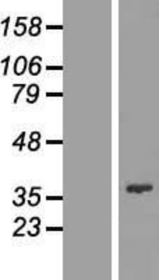 Western Blot: FYTTD1 Overexpression Lysate (Adult Normal) [NBL1-10888] Left-Empty vector transfected control cell lysate (HEK293 cell lysate); Right -Over-expression Lysate for FYTTD1.