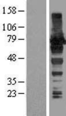 Western Blot: HA95/AKAP8L Overexpression Lysate (Adult Normal) [NBL1-07430] Left-Empty vector transfected control cell lysate (HEK293 cell lysate); Right -Over-expression Lysate for HA95/AKAP8L.