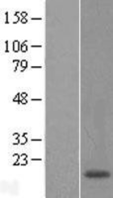 Western Blot: POLR1D Overexpression Lysate (Adult Normal) [NBL1-14576] Left-Empty vector transfected control cell lysate (HEK293 cell lysate); Right -Over-expression Lysate for POLR1D.