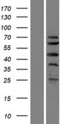 Western Blot: C1orf124 Overexpression Lysate (Adult Normal) [NBP2-06088] Left-Empty vector transfected control cell lysate (HEK293 cell lysate); Right -Over-expression Lysate for C1orf124.