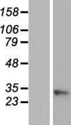 Western Blot: GAJ Overexpression Lysate (Adult Normal) [NBP2-06069] Left-Empty vector transfected control cell lysate (HEK293 cell lysate); Right -Over-expression Lysate for GAJ.