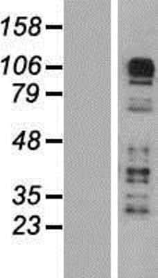 Western Blot: CARD6 Overexpression Lysate (Adult Normal) [NBP2-05992] Left-Empty vector transfected control cell lysate (HEK293 cell lysate); Right -Over-expression Lysate for CARD6.