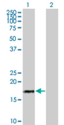 Lane 1: IFNA17 transfected lysate (21.7 KDa) Lane 2: Non-transfected lysate.