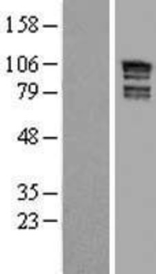 Western Blot: ARHGAP17 Overexpression Lysate (Adult Normal) [NBL1-07667] Left-Empty vector transfected control cell lysate (HEK293 cell lysate); Right -Over-expression Lysate for ARHGAP17.