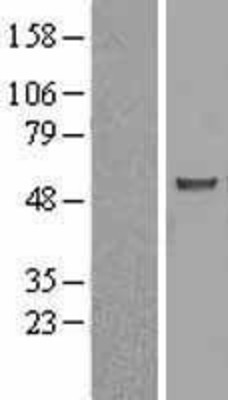 Western Blot: ASB3 Overexpression Lysate (Adult Normal) [NBL1-07750] Left-Empty vector transfected control cell lysate (HEK293 cell lysate); Right -Over-expression Lysate for ASB3.