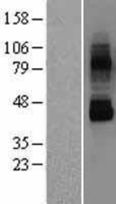 Western Blot: TRPV6 Overexpression Lysate (Adult Normal) [NBL1-17345] Left-Empty vector transfected control cell lysate (HEK293 cell lysate); Right -Over-expression Lysate for TRPV6.