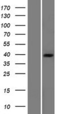 Western Blot: Pyruvate Dehydrogenase E1 beta subunit Overexpression Lysate (Adult Normal) [NBP2-11466] Left-Empty vector transfected control cell lysate (HEK293 cell lysate); Right -Over-expression Lysate for Pyruvate Dehydrogenase E1 beta subunit.