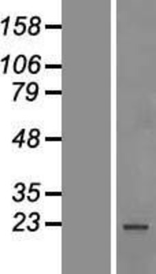 Western Blot: SF2 Overexpression Lysate (Adult Normal) [NBP2-11448] Left-Empty vector transfected control cell lysate (HEK293 cell lysate); Right -Over-expression Lysate for SF2.