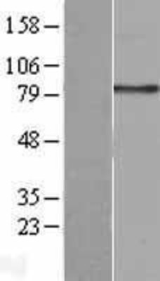 Western Blot: Integrin beta 2/CD18 Overexpression Lysate (Adult Normal) [NBP2-11372] Left-Empty vector transfected control cell lysate (HEK293 cell lysate); Right -Over-expression Lysate for Integrin beta 2/CD18.