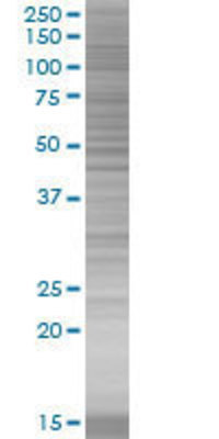 ATF6 transfected lysate.