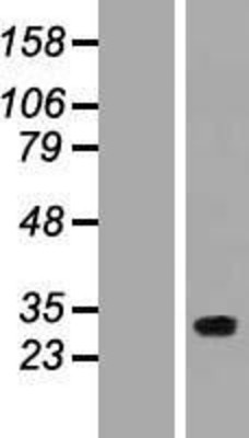Western Blot: FLJ14154 Overexpression Lysate (Adult Normal) [NBP2-11444] Left-Empty vector transfected control cell lysate (HEK293 cell lysate); Right -Over-expression Lysate for FLJ14154.